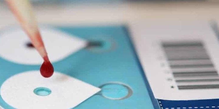 Free Webinar: Dispositivi di microcampionamento qDBS